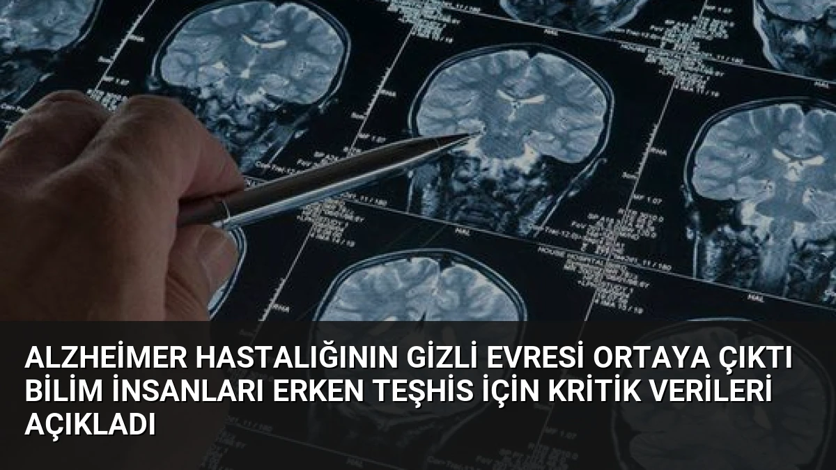 Alzheimer Hastalığının Gizli Evresi Ortaya Çıktı Bilim İnsanları Erken Teşhis İçin Kritik Verileri Açıkladı