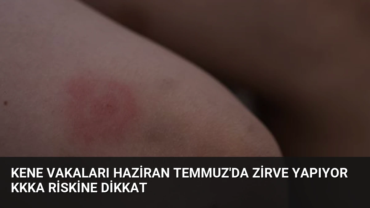 Kene Vakaları Haziran Temmuz’da Zirve Yapıyor KKKA Riskine Dikkat