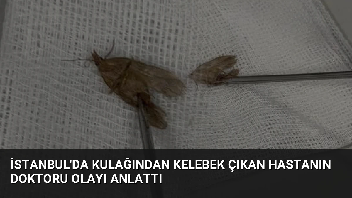 İstanbul’da Kulağından Kelebek Çıkan Hastanın Doktoru Olayı Anlattı