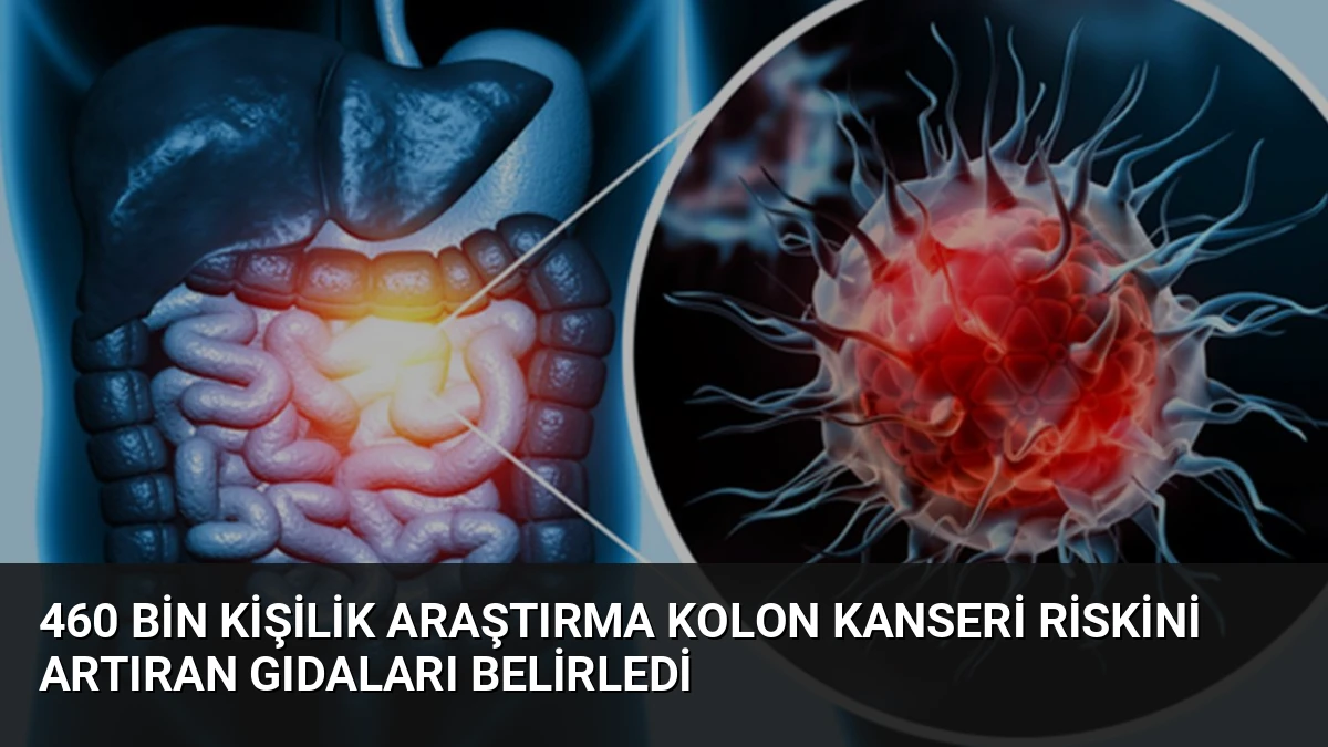 460 Bin Kişilik Araştırma Kolon Kanseri Riskini Artıran Gıdaları Belirledi